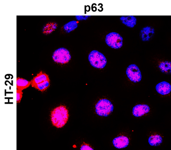 p63 Rabbit Polyclonal Antibody