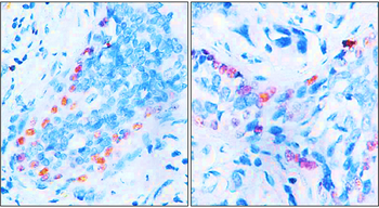 p63 Rabbit Polyclonal Antibody