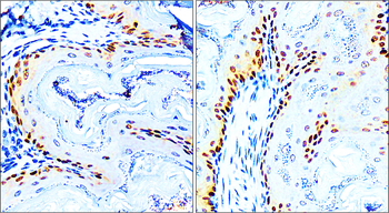 p63 Rabbit Polyclonal Antibody