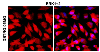 ERK1+2 Rabbit Polyclonal Antibody