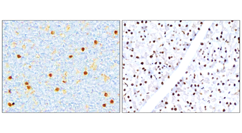 NFE2L2 Rabbit Polyclonal Antibody