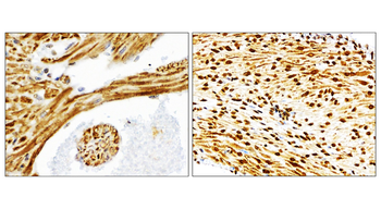 NFE2L2 Rabbit Polyclonal Antibody