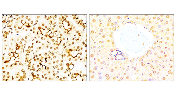 NFE2L2 Rabbit Polyclonal Antibody