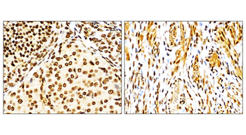 NFE2L2 Rabbit Polyclonal Antibody