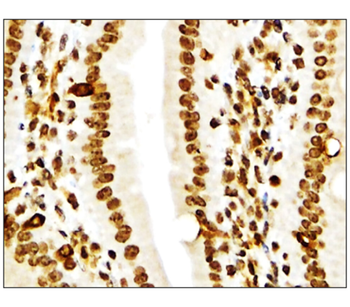 NFE2L2 Rabbit Polyclonal Antibody