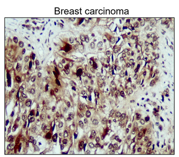NFE2L2 Rabbit Polyclonal Antibody