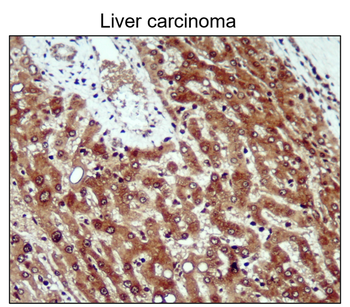 NFE2L2 Rabbit Polyclonal Antibody