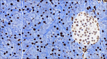 NFE2L2 Rabbit Polyclonal Antibody