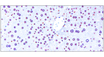 NFE2L2 Rabbit Polyclonal Antibody