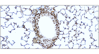 NFE2L2 Rabbit Polyclonal Antibody