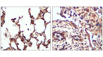 ATF6 Rabbit Polyclonal Antibody