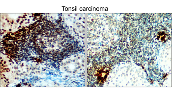 IRE1α Rabbit Polyclonal Antibody