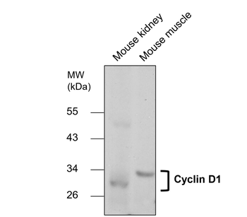 Cyclin D1 Rabbit Polyclonal Antibody