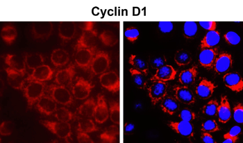 Cyclin D1 Rabbit Polyclonal Antibody