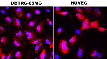 IL-1 beta Rabbit Polyclonal Antibody