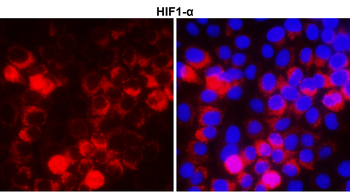 HIF1A Rabbit Polyclonal Antibody