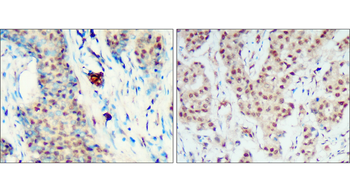HIF1A Rabbit Polyclonal Antibody