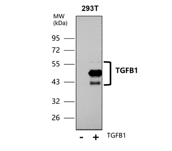 TGF beta 1 Rabbit Polyclonal Antibody