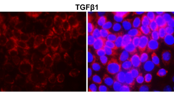 TGF beta 1 Rabbit Polyclonal Antibody