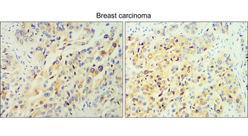 TGF beta 1 Rabbit Polyclonal Antibody