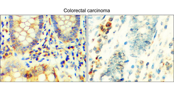TGF beta 1 Rabbit Polyclonal Antibody