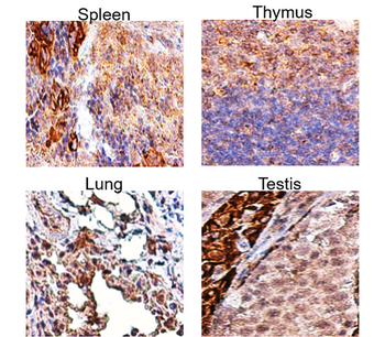 TGF beta 1 Rabbit Polyclonal Antibody