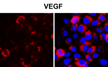 VEGF Rabbit Polyclonal Antibody