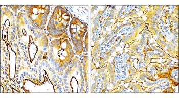 VEGF Rabbit Polyclonal Antibody