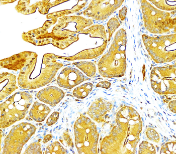 VEGF Rabbit Polyclonal Antibody
