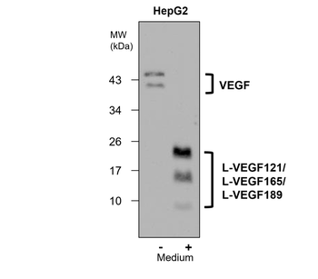 VEGF Rabbit Polyclonal Antibody