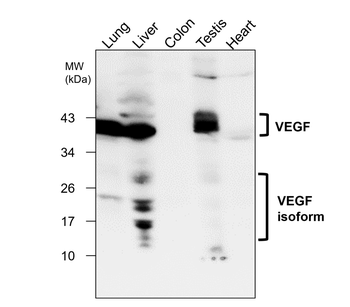 VEGF Rabbit Polyclonal Antibody