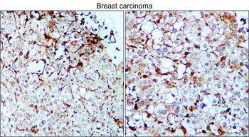 VEGF Rabbit Polyclonal Antibody