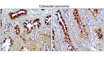 VEGF Rabbit Polyclonal Antibody