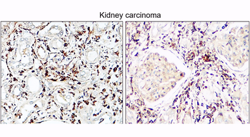 VEGF Rabbit Polyclonal Antibody