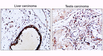 VEGF Rabbit Polyclonal Antibody