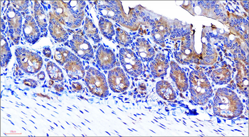 VEGF Rabbit Polyclonal Antibody