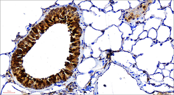 VEGF Rabbit Polyclonal Antibody