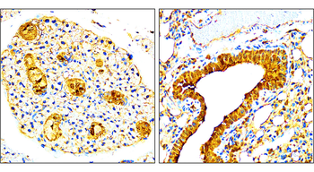 VEGF Rabbit Polyclonal Antibody