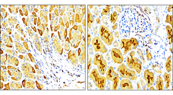 VEGF Rabbit Polyclonal Antibody
