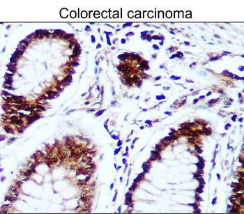 Survivin Rabbit Polyclonal Antibody