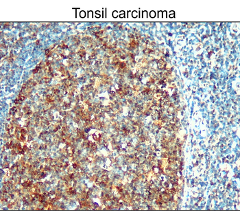 Survivin Rabbit Polyclonal Antibody