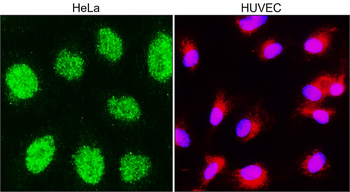 PARP1 Rabbit Polyclonal Antibody