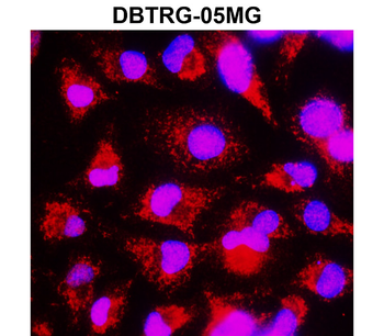 cleaved PARP Asp214 Rabbit Polyclonal Antibody