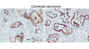 BAX Rabbit Polyclonal Antibody