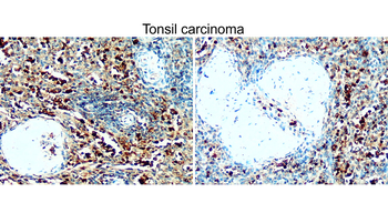 BAX Rabbit Polyclonal Antibody