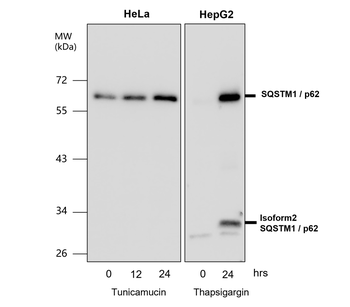 SQSTM1 Rabbit Polyclonal Antibody