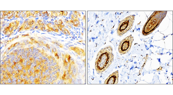 SQSTM1 Rabbit Polyclonal Antibody