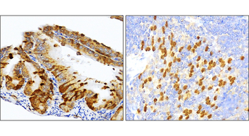 SQSTM1 Rabbit Polyclonal Antibody