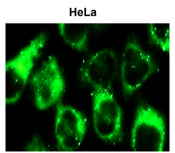 SQSTM1 Rabbit Polyclonal Antibody