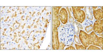 SQSTM1 Rabbit Polyclonal Antibody